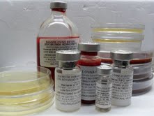 toxoplasma gondii